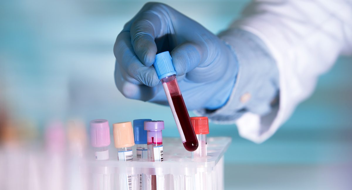 Diagnostic screening diagnostic screening testing